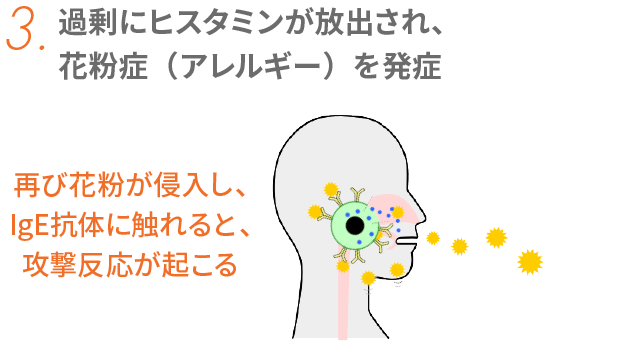 3. 過剰にヒスタミンが放出され、花粉症（アレルギー）を発症